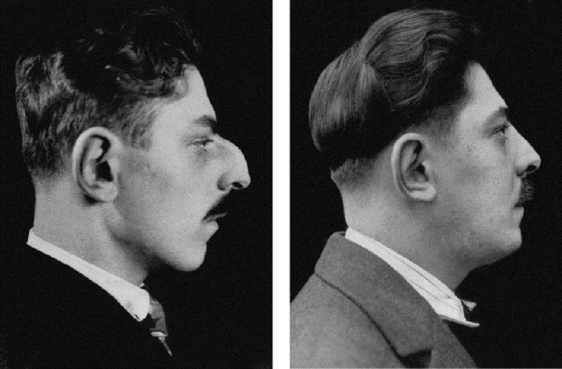 Quand a été créé la chirurgie esthétique ? Geek Medical